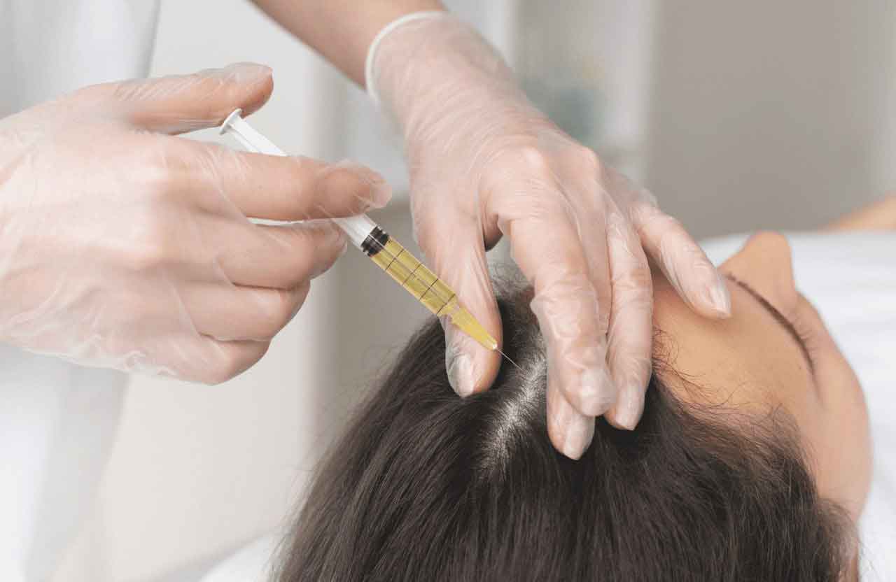 What is a hair filler?