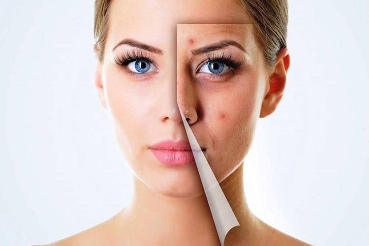 بهترین شوینده صورت برای پوست چرب