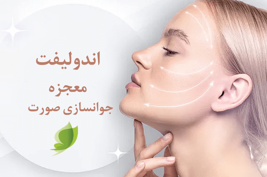 اندولیفت