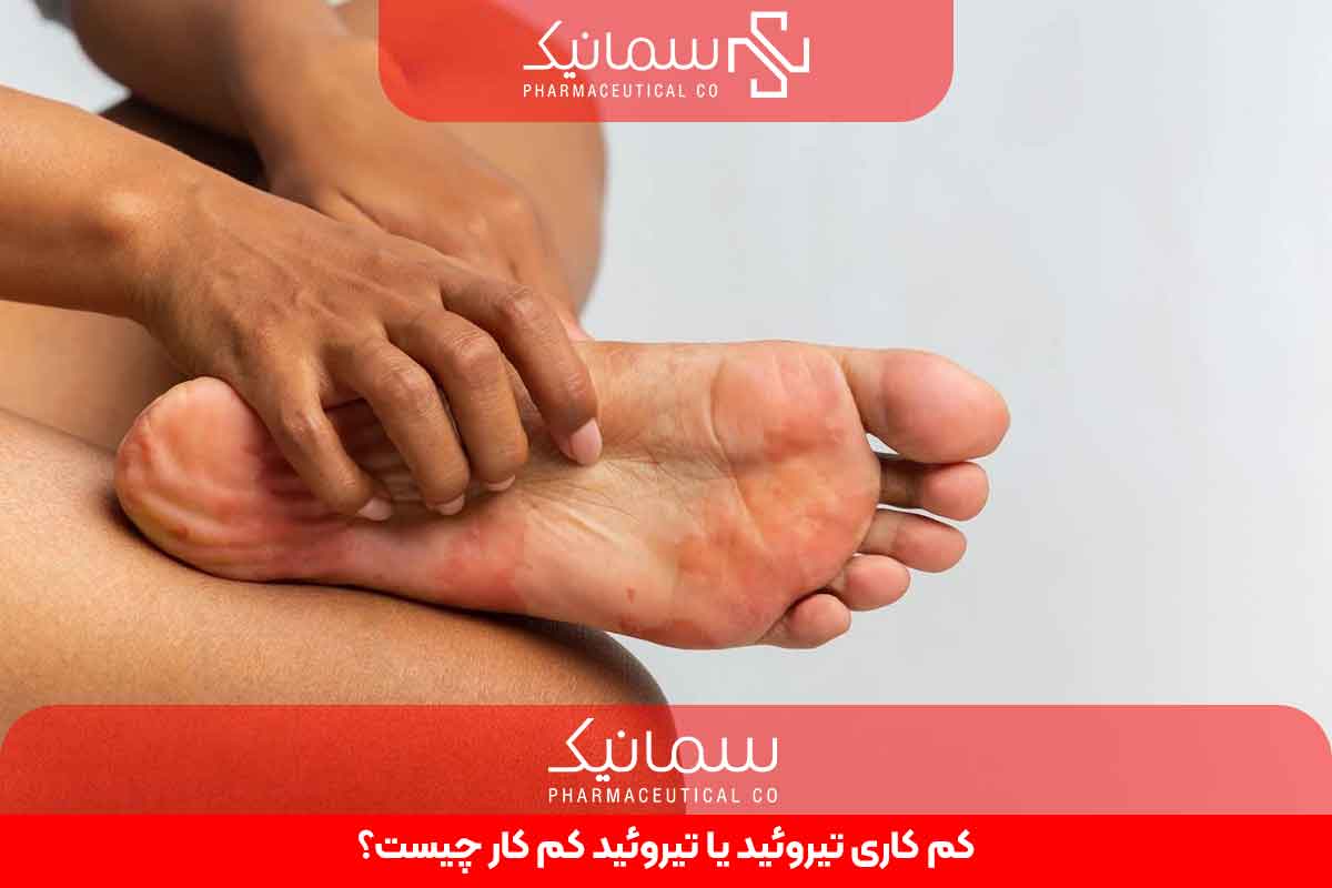 کم کاری تیروئید یا تیروئید کم کار چیست؟