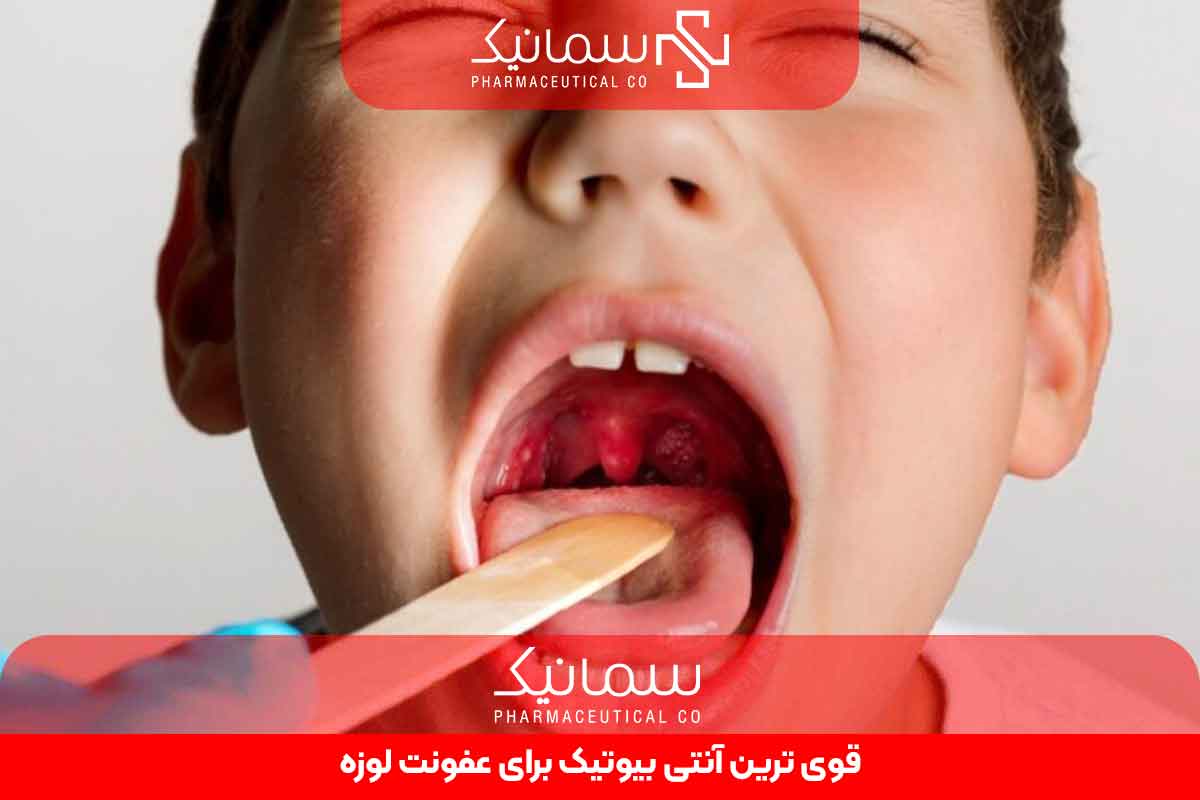 قوی ترین آنتی بیوتیک برای عفونت لوزه