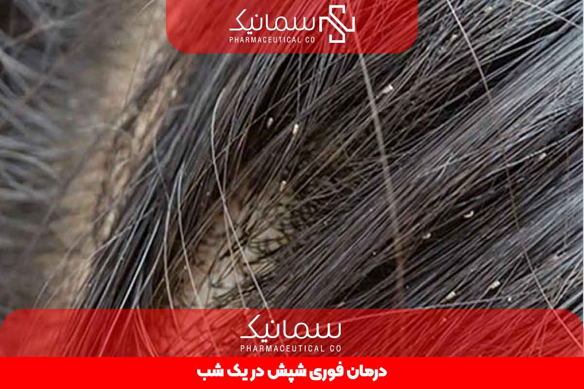 درمان فوری شپش در یک شب
