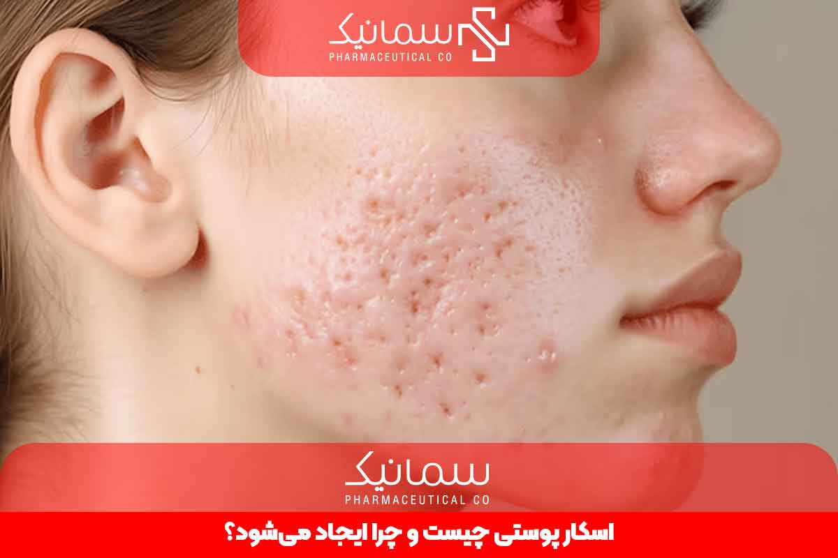 اسکار پوستی چیست و چرا ایجا می‌شود؟