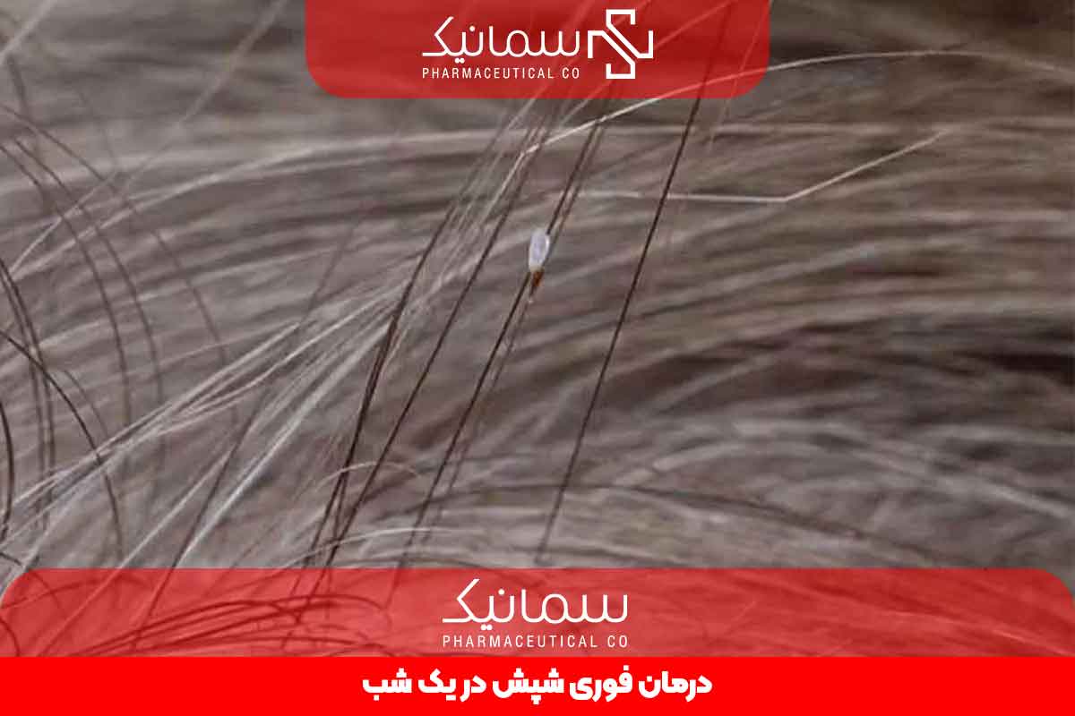 درمان فوری شپش در یک شب