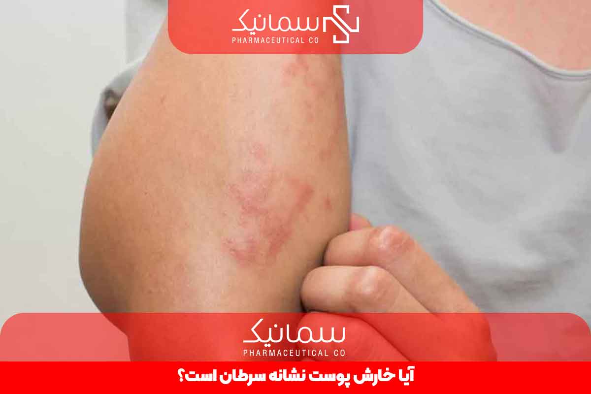 آیا خارش پوست نشانه سرطان است؟