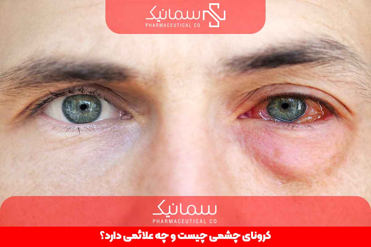  کرونای چشمی چیست و چه علائمی دارد؟