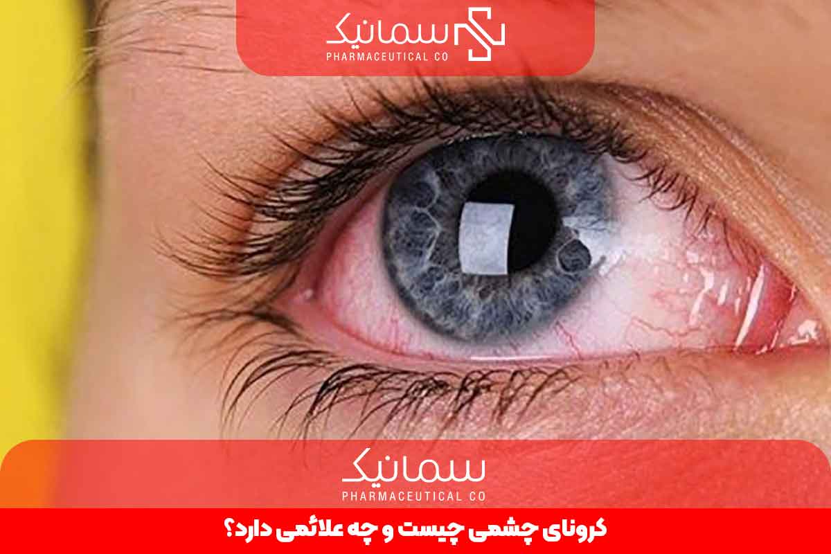  کرونای چشمی چیست و چه علائمی دارد؟