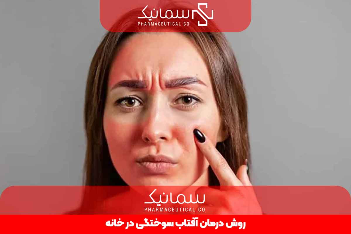 روش درمان آفتاب سوختگی در خانه