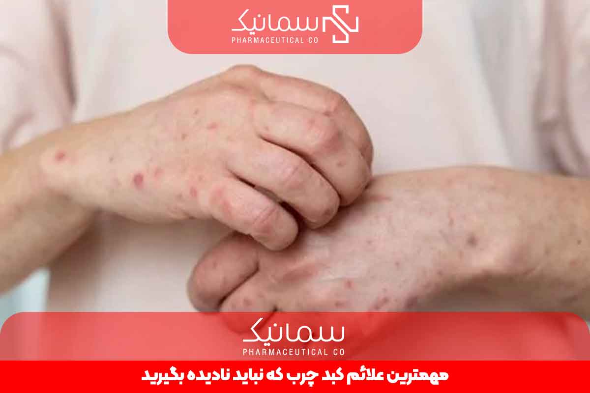 مهمترین علائم کبد چرب که نباید نادیده بگیرید