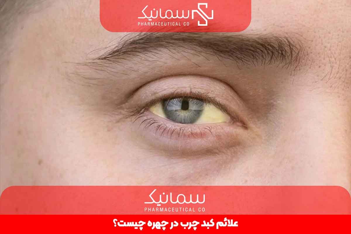 علائم کبد چرب در چهره چیست؟