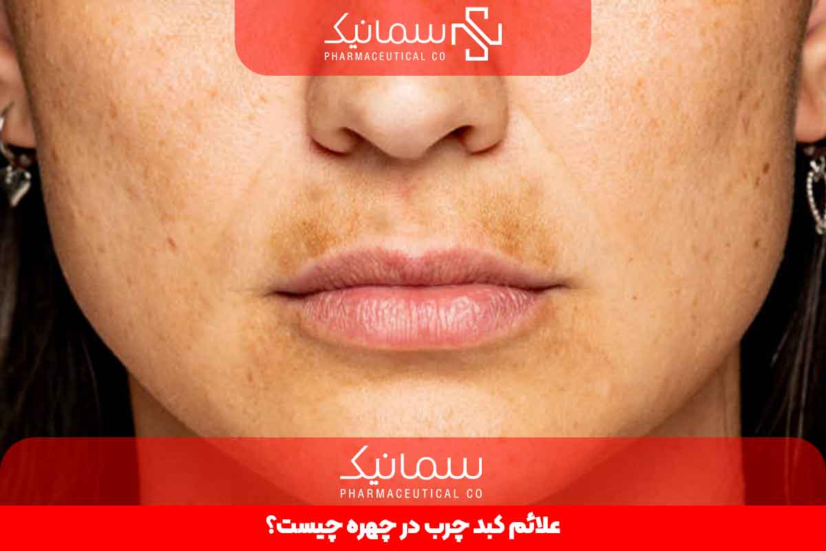 علائم کبد چرب در چهره چیست؟