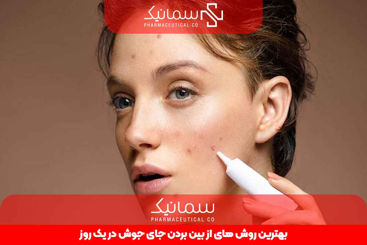بهترین روش های از بین بردن جوش در یک روز