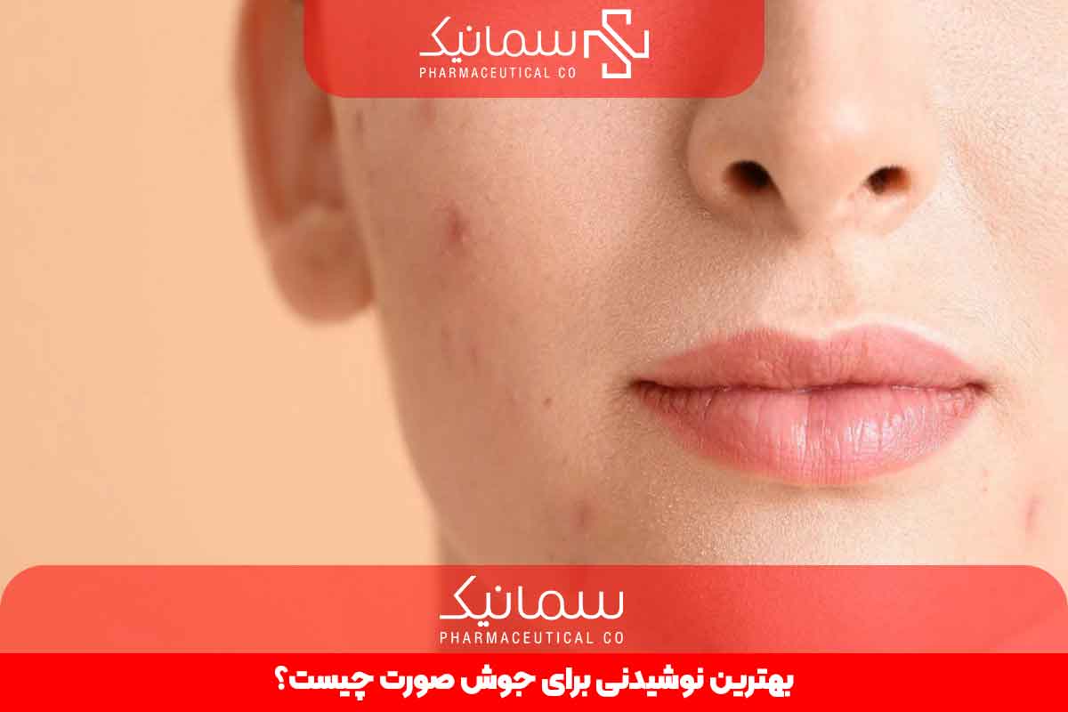 بهترین نوشیدنی برای جوش صورت چیست؟