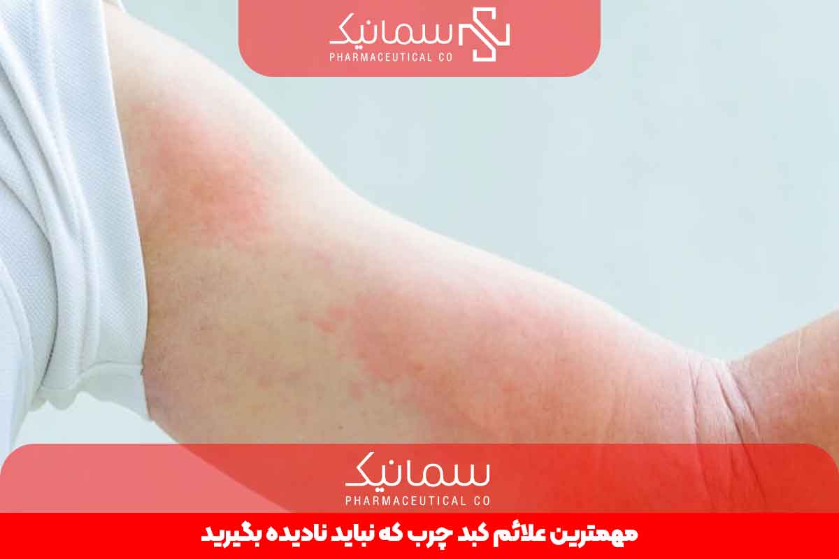 مهمترین علائم کبد چرب که نباید نادیده بگیرید