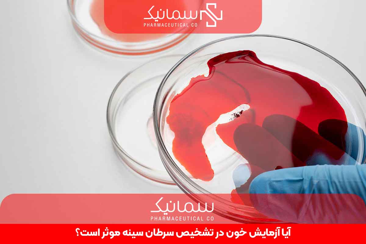 آزمایش خون در تشخیص سرطان سینه