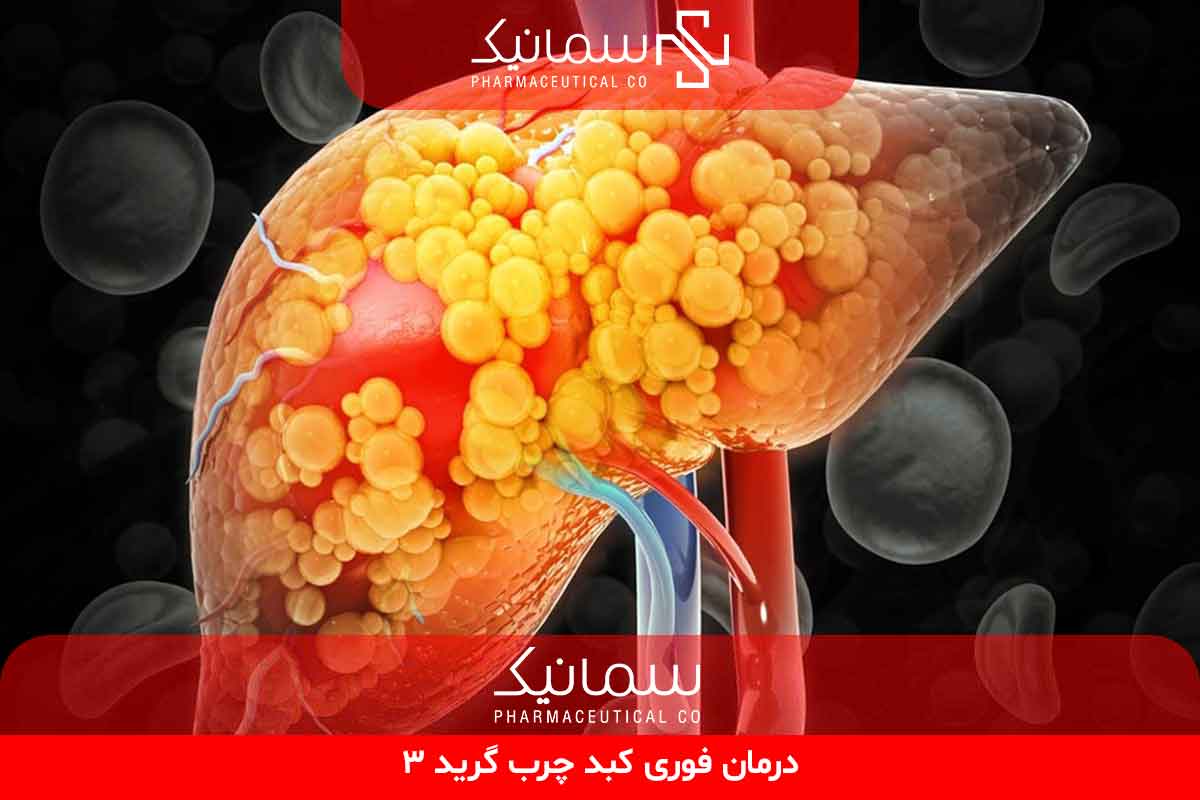 درمان فوری کبد چرب گرید ۳
