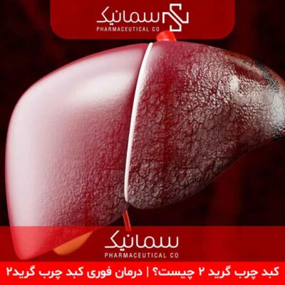 درمان فوری کبد چرب گرید۲