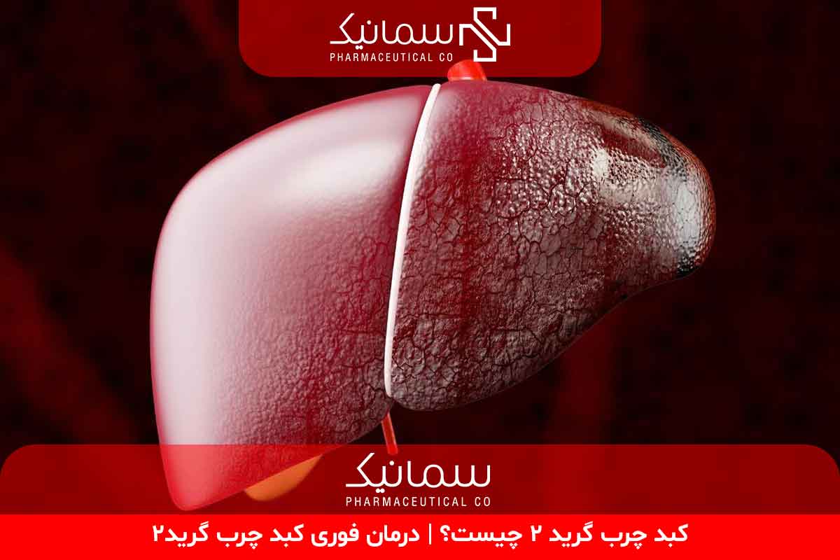 درمان فوری کبد چرب گرید۲