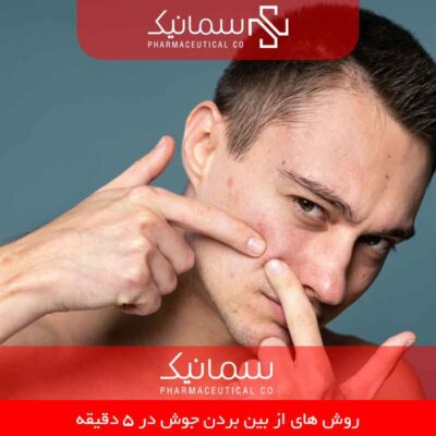 از بین بردن جوش در ۵ دقیقه