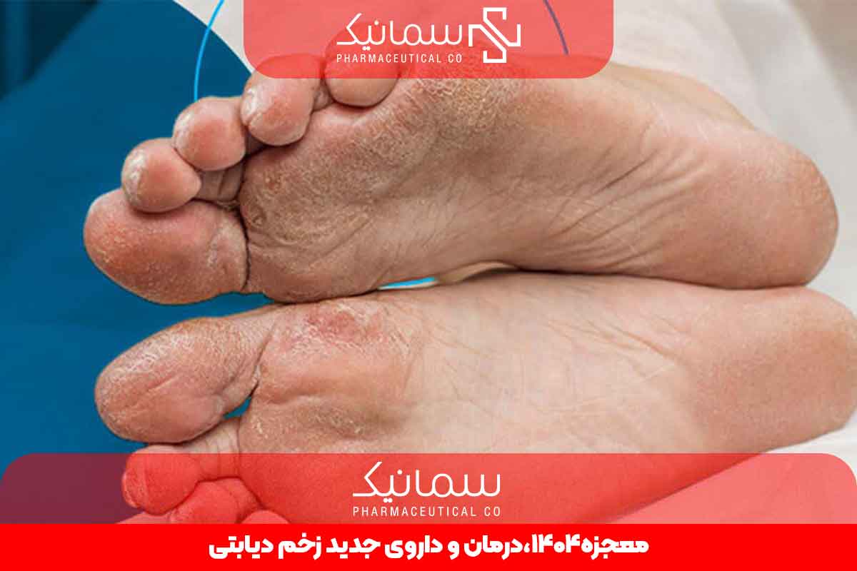 داروی جدید زخم دیابتی