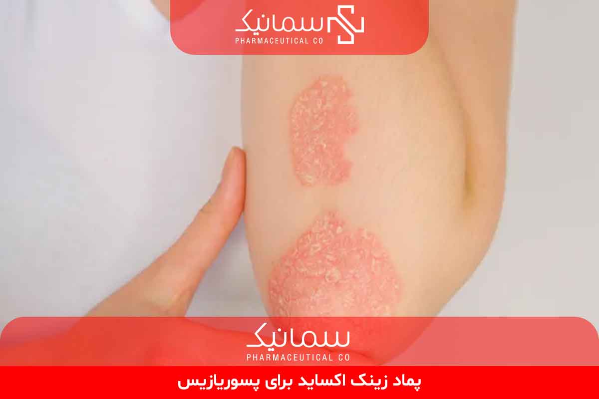 پماد زینک اکساید برای پسوریازیس