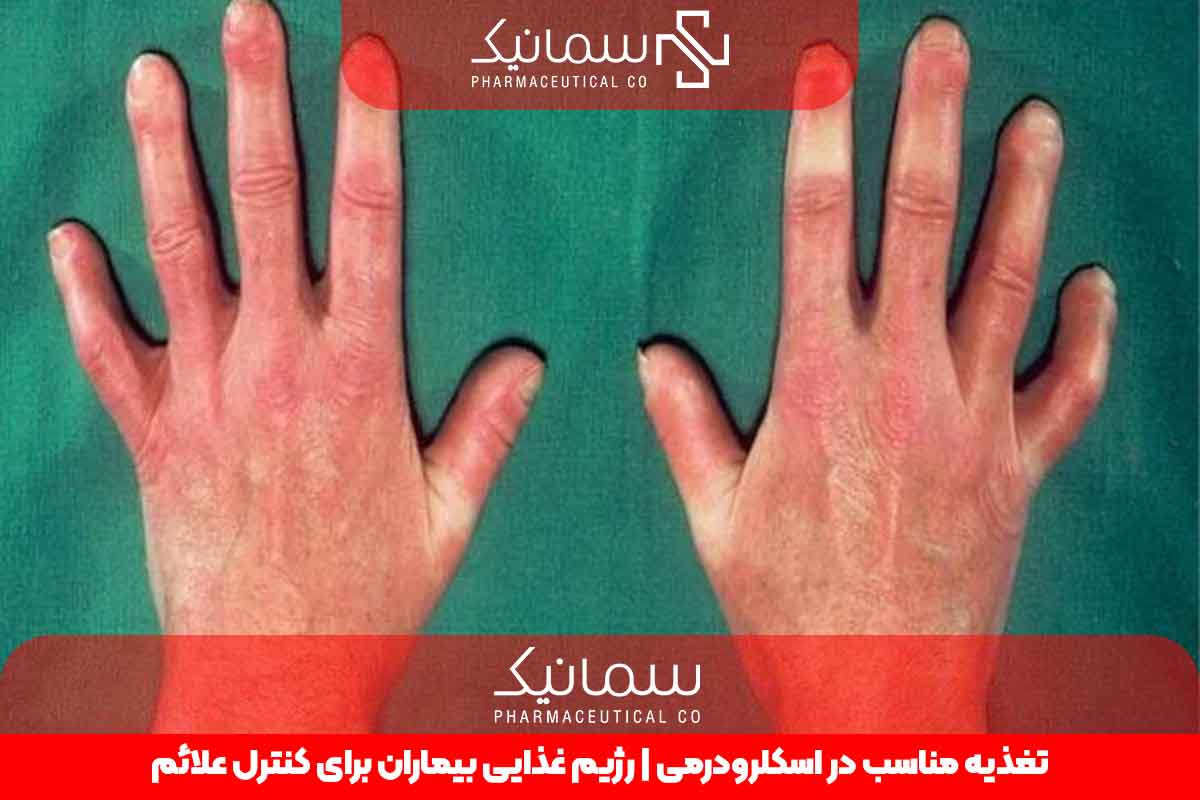 تغذیه مناسب در اسکلرودرمی