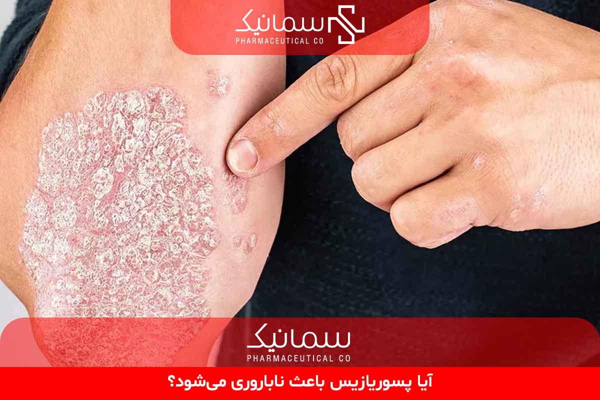 آیا پسوریازیس باعث ناباروری می‌شود