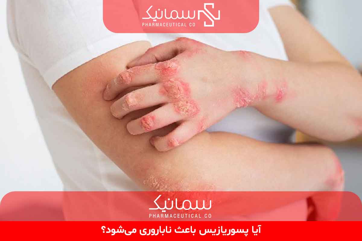 آیا پسوریازیس باعث ناباروری می‌شود؟