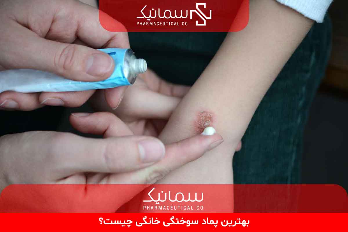بهترین پماد سوختگی خانگی