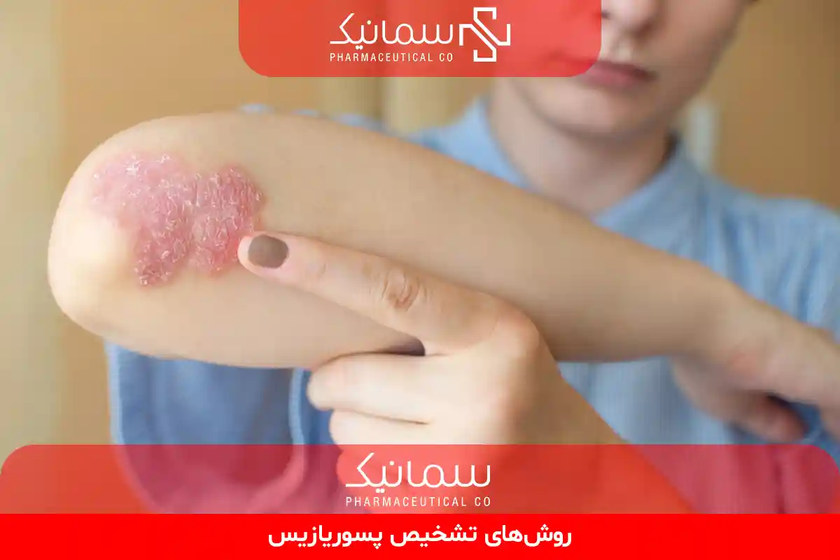 روش‌های تشخیص پسوریازیس