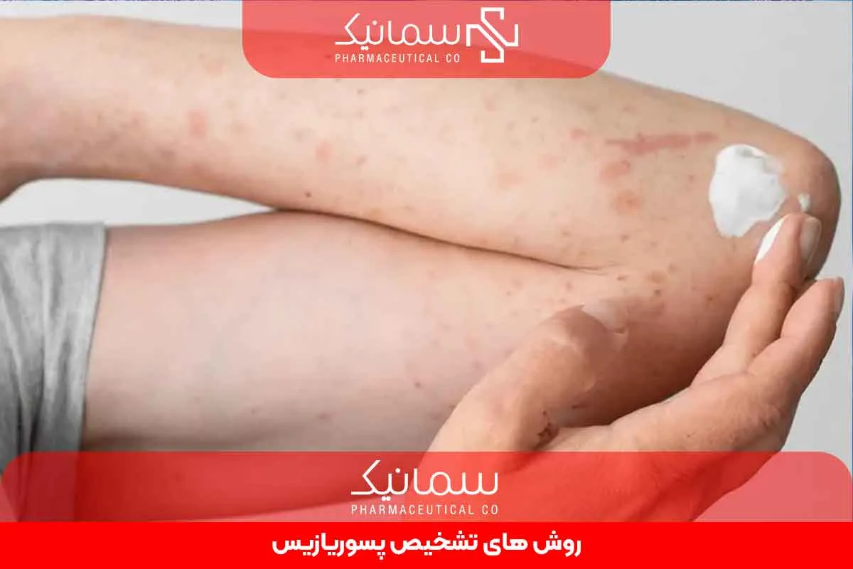 روش‌های تشخیص پسوریازیس