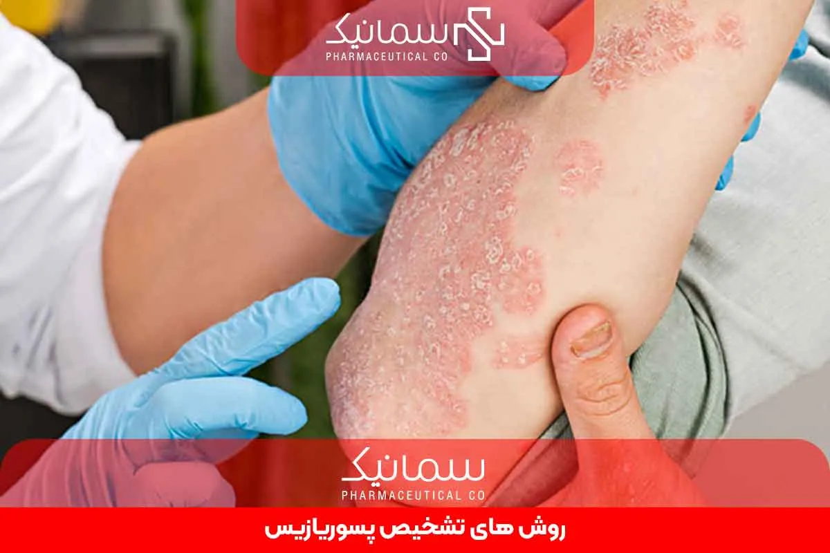 روش‌های تشخیص پسوریازیس
