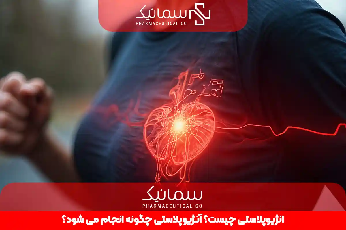 آنژیوپلاستی