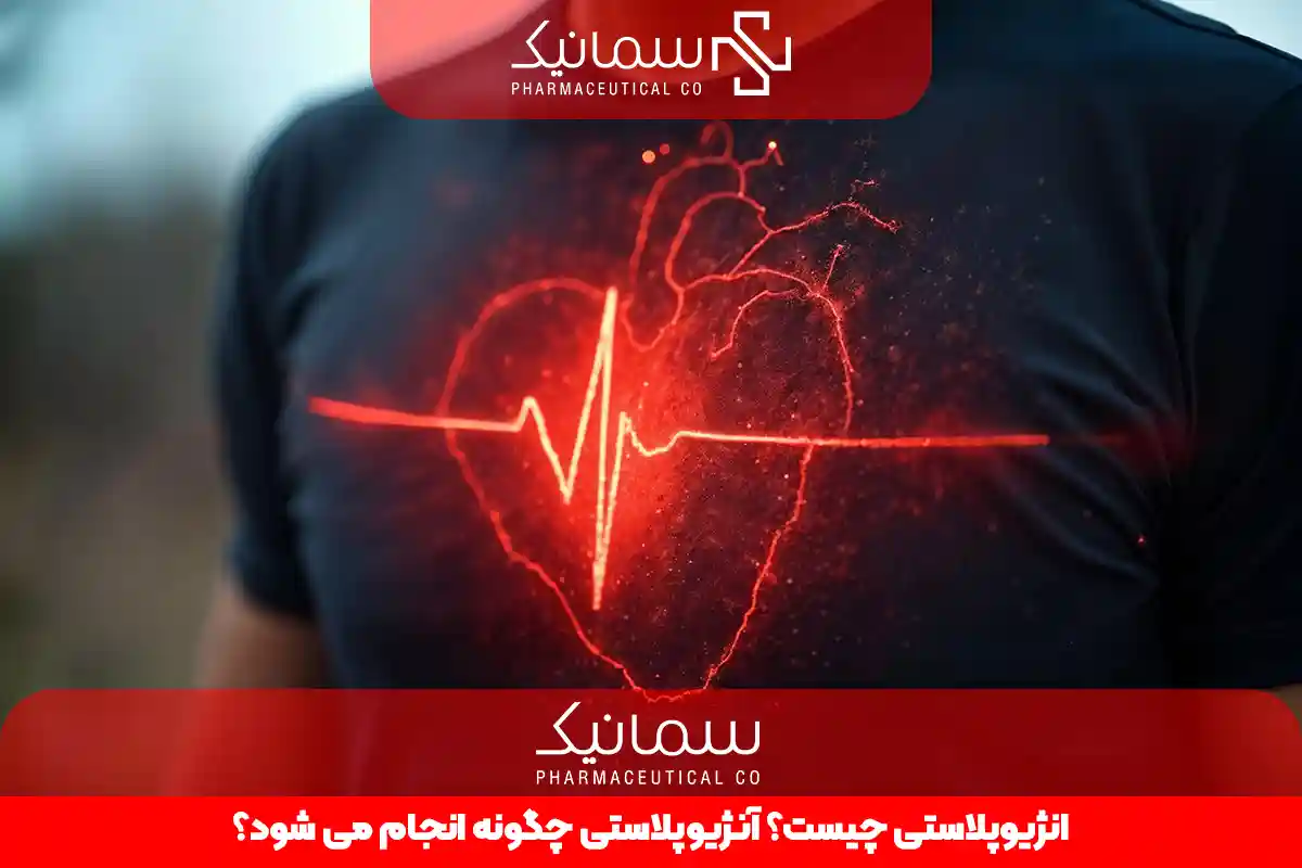 آنژیوپلاستی