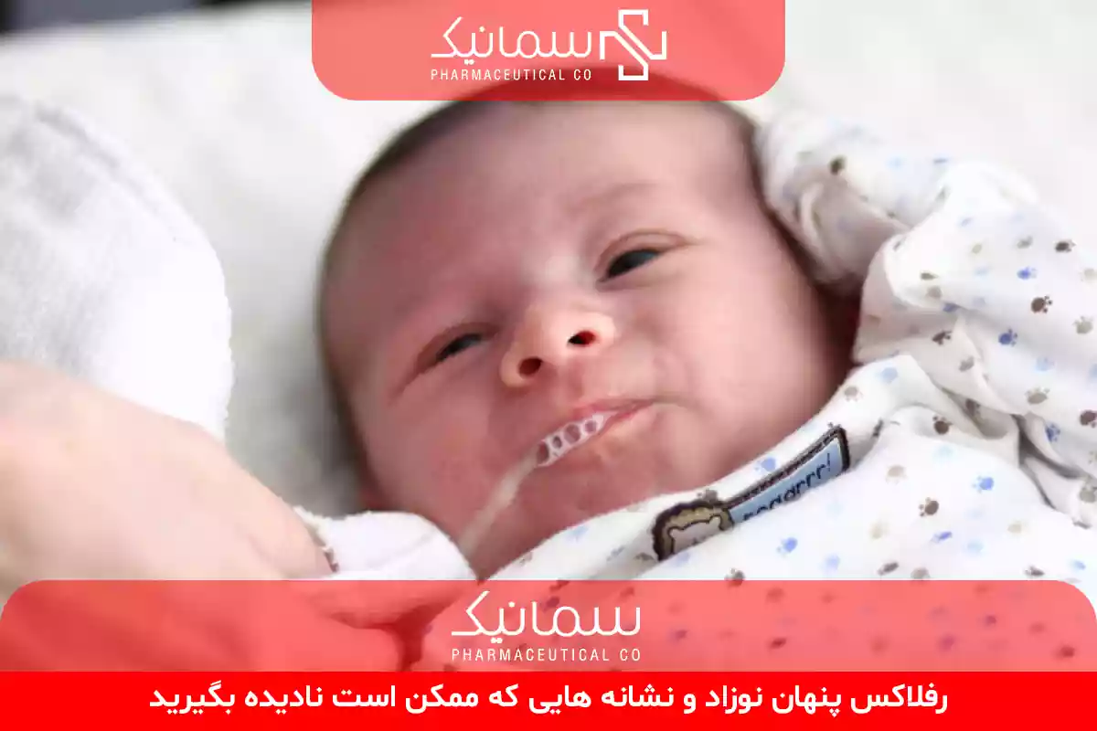 رفلاکس پنهان نوزادان