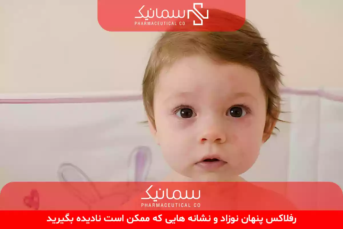 رفلاکس پنهان نوزادان