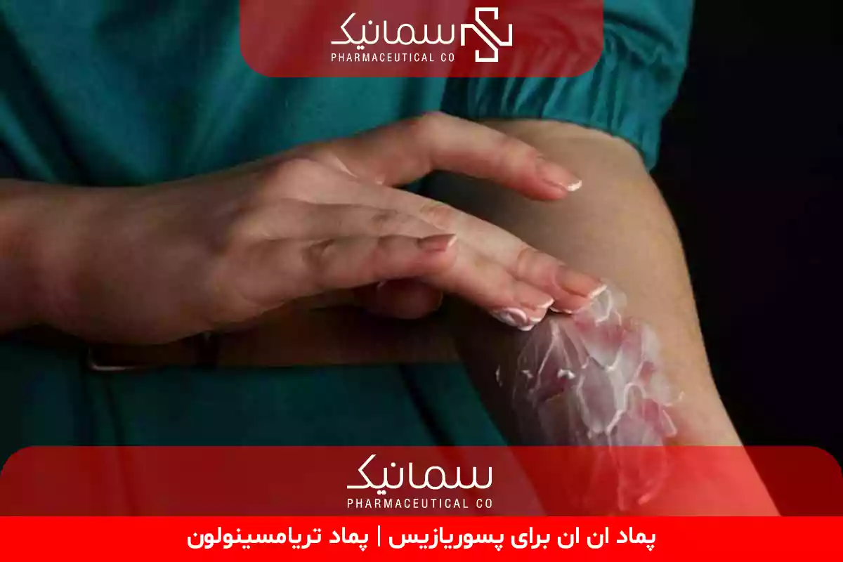 پماد ان ان برای پسوریازیس