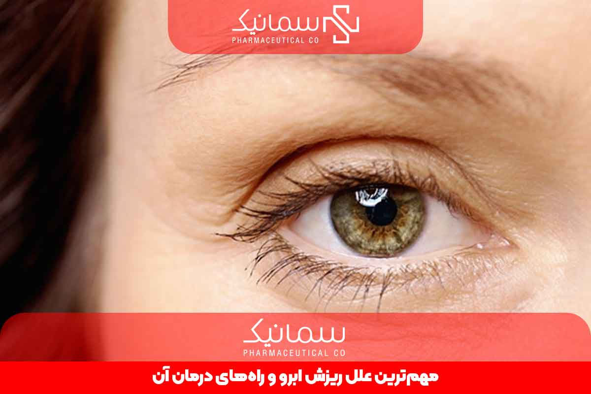 ریزش ابرو