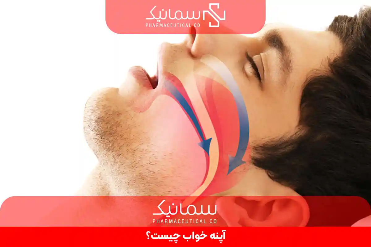 آپنه خواب