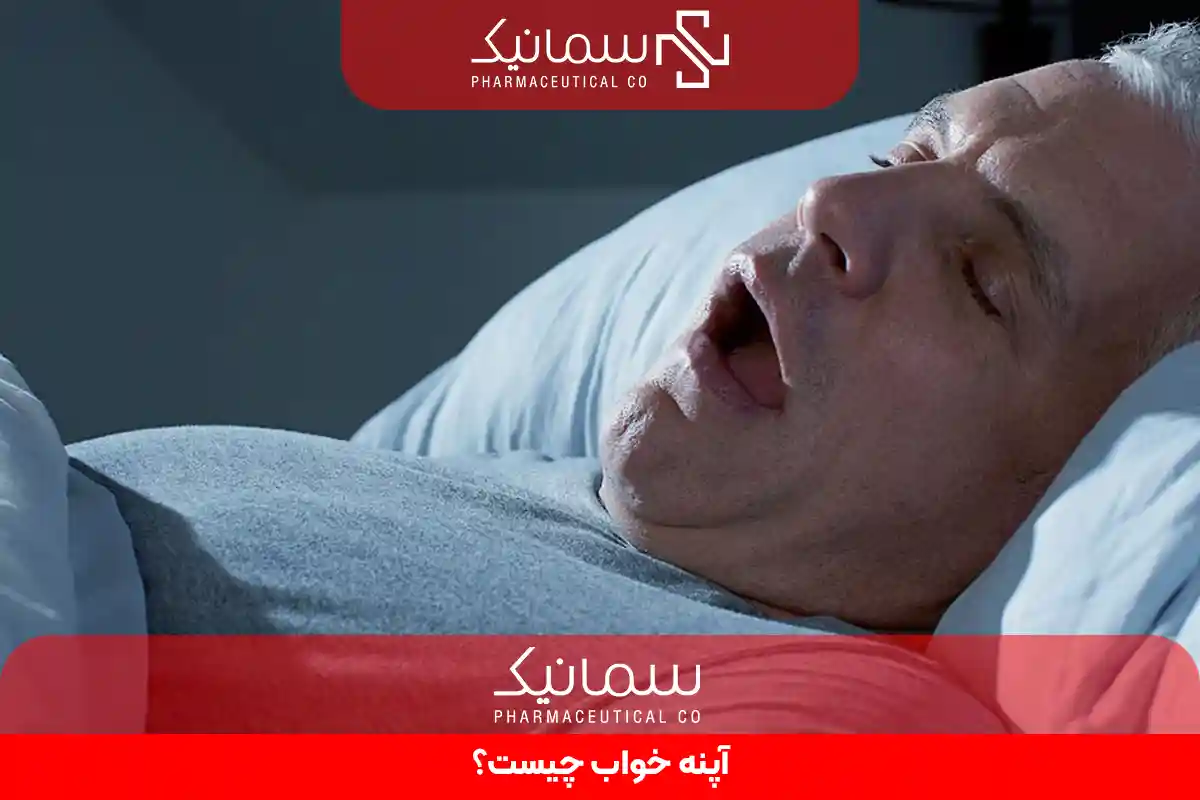 آپنه خواب