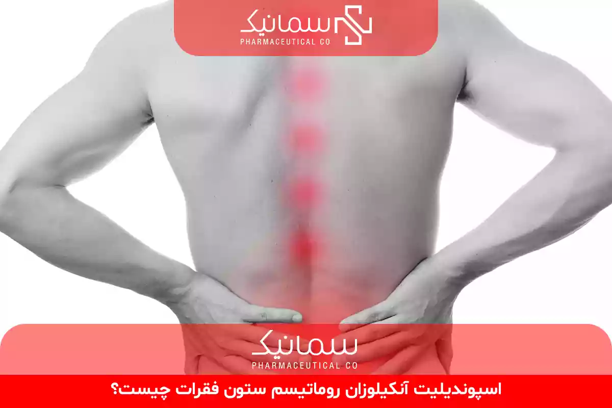 اسپوندیلیت آنکیلوزان