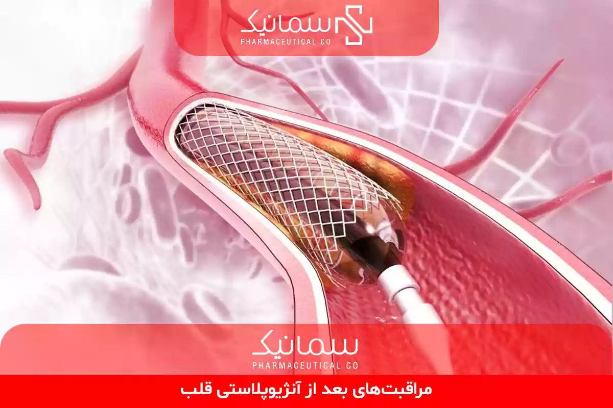 مراقبت‌های بعد از آنژیوپلاستی