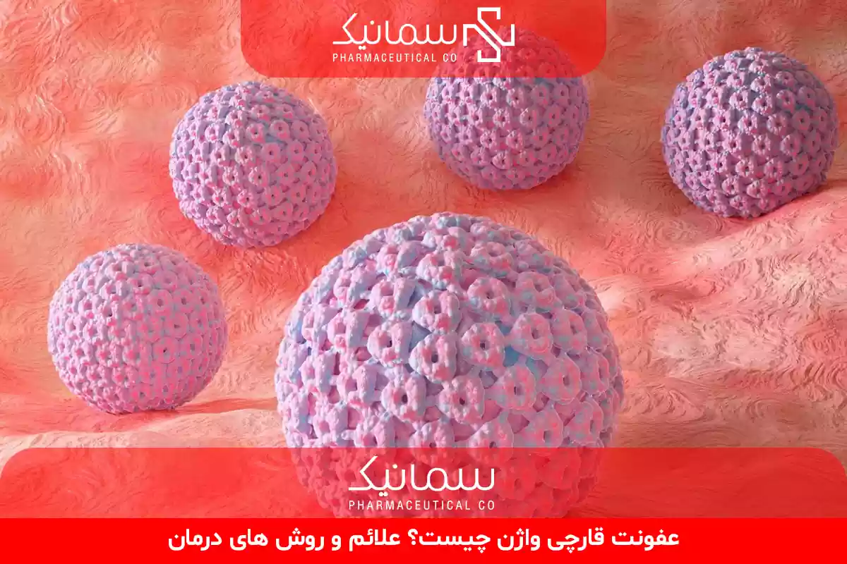 عفونت قارچی واژن
