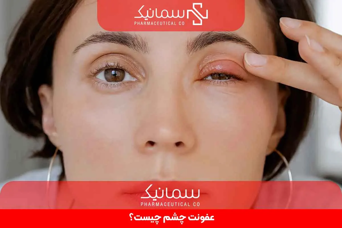 عفونت چشم چیست؟