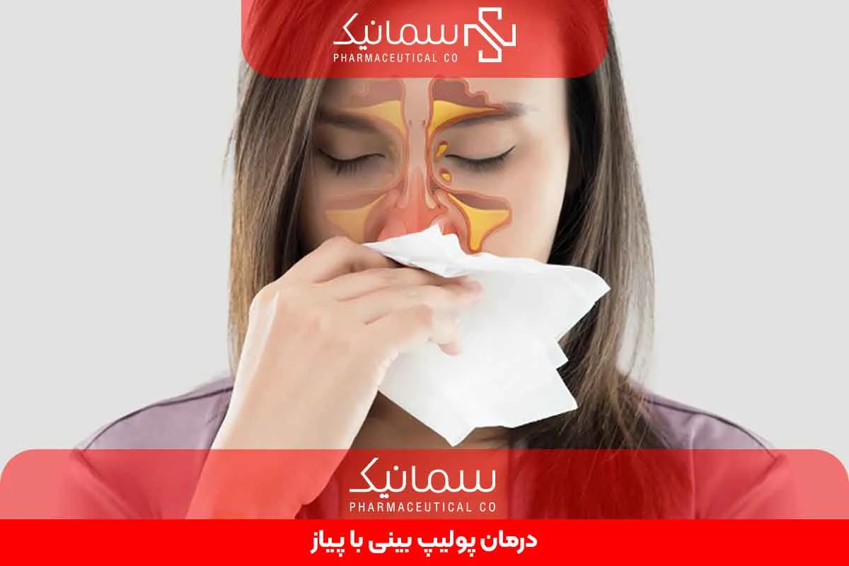 درمان پولیپ بینی با پیاز
