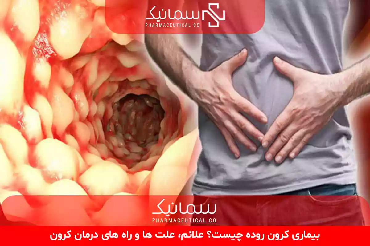 بیماری کرون