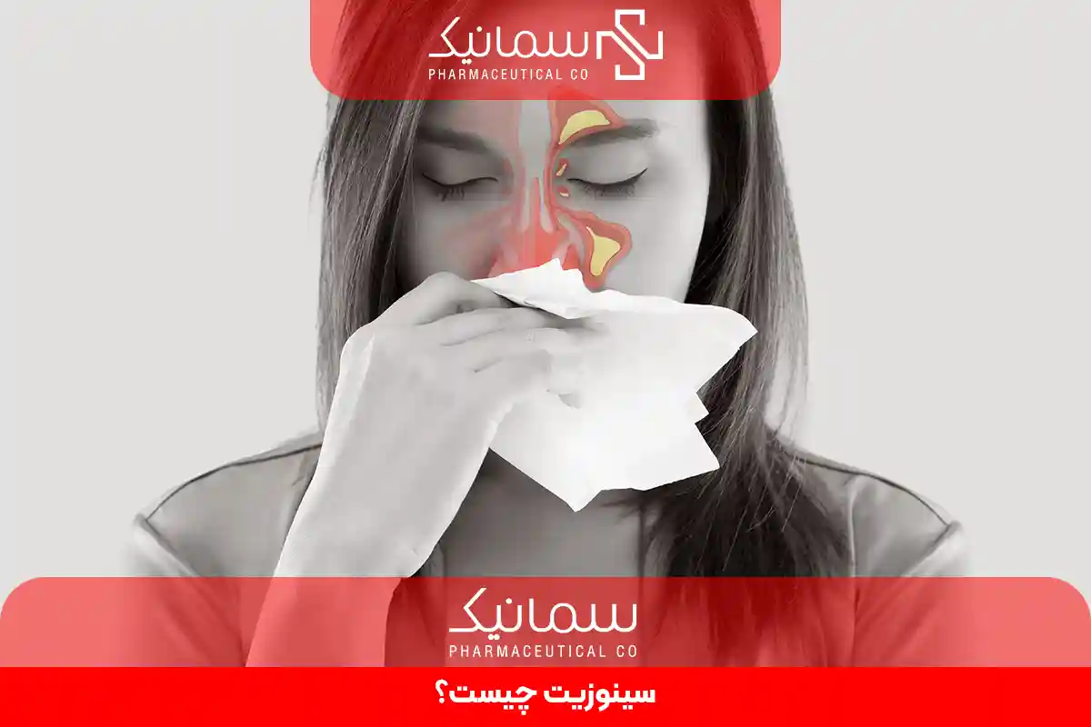 سینوزیت