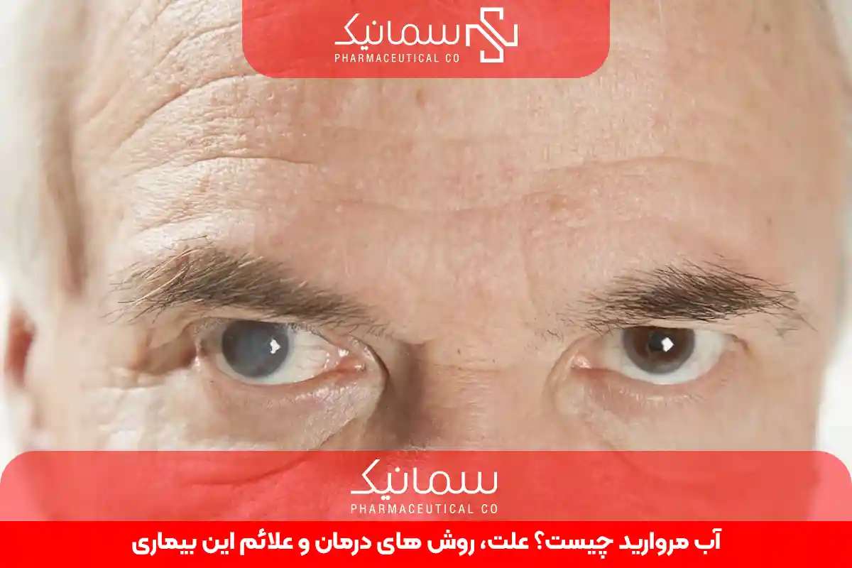 آب مروارید