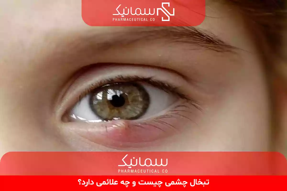 تبخال چشمی