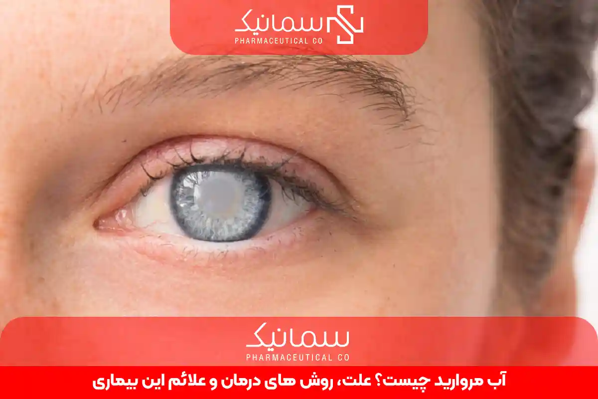آب مروارید